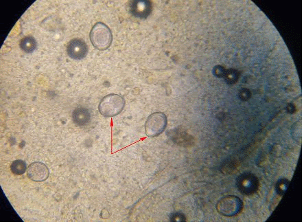 Coccidiosis en cerdos