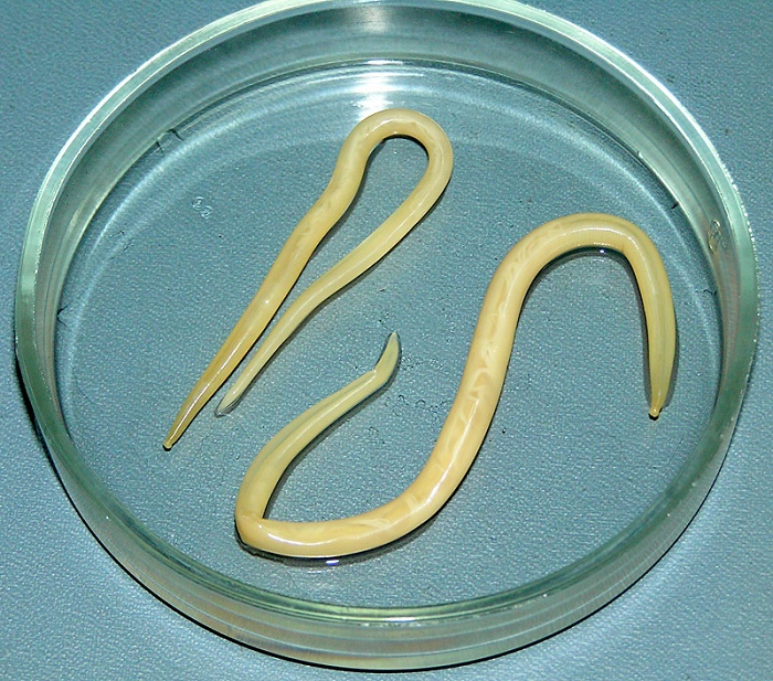 Ascariasis